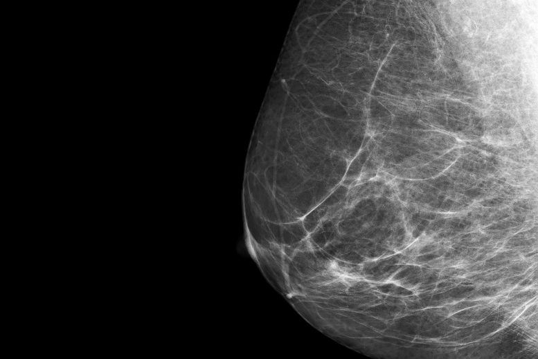 Breast Cancer X-Ray Mammogram Close Up