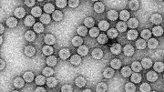 Brome Mosaic Virus Virions