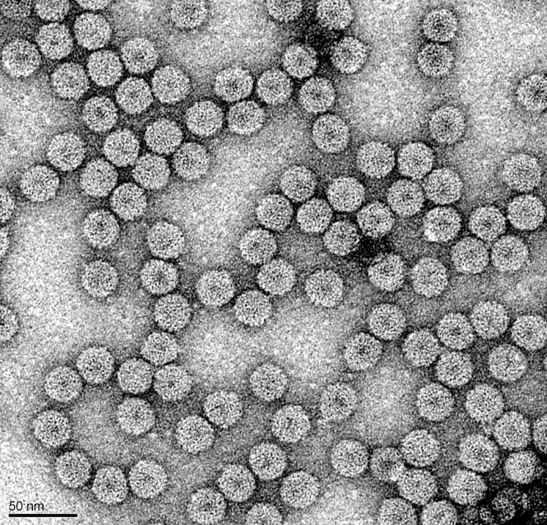 Brome Mosaic Virus Virions