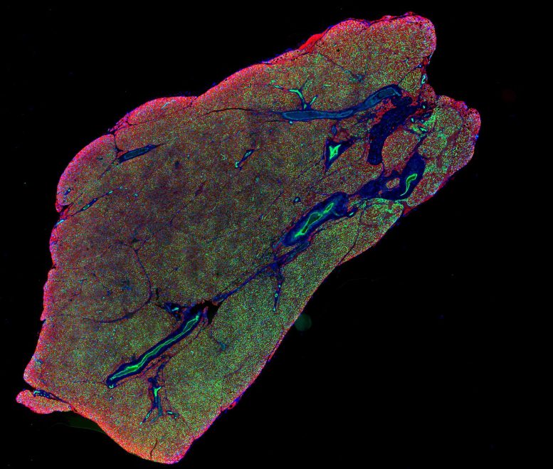 Brown Adipose Tissue (Fat)