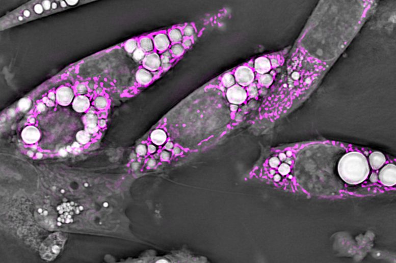 Brown Fat Cells With Magenta Labeled Mitochondria