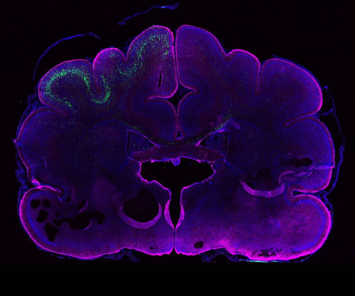Researchers Discover Human-Specific Gene for Building a Bigger Brain1199 x 1000