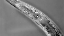 C elegans High Resolution Microscope