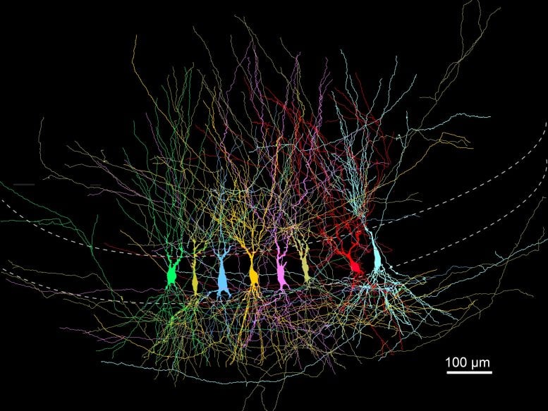 Your Brain Starts Overloaded Then Cuts Itself Down for Better Memory
