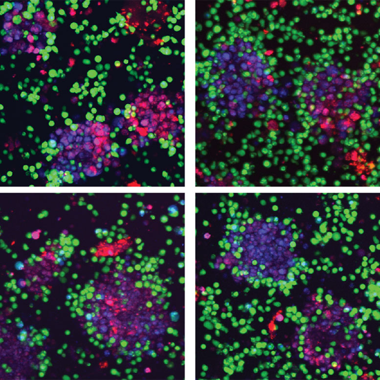 CAR T Cells Targeting Colorectal Cancer Organoids