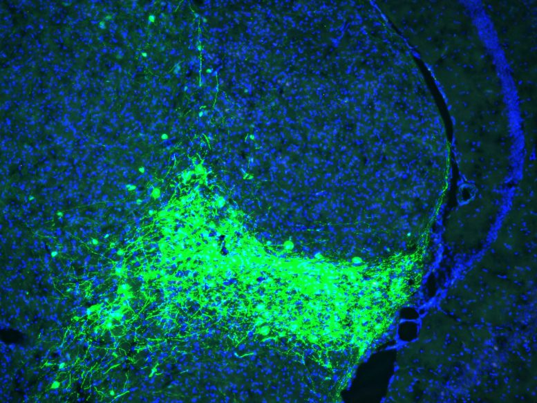 CGRP Neurons