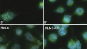 CLN3 Protein