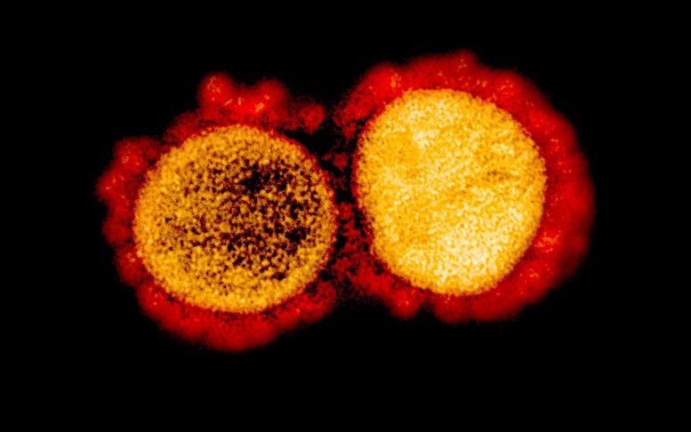 COVID-19 Coronavirus SARS-CoV-2