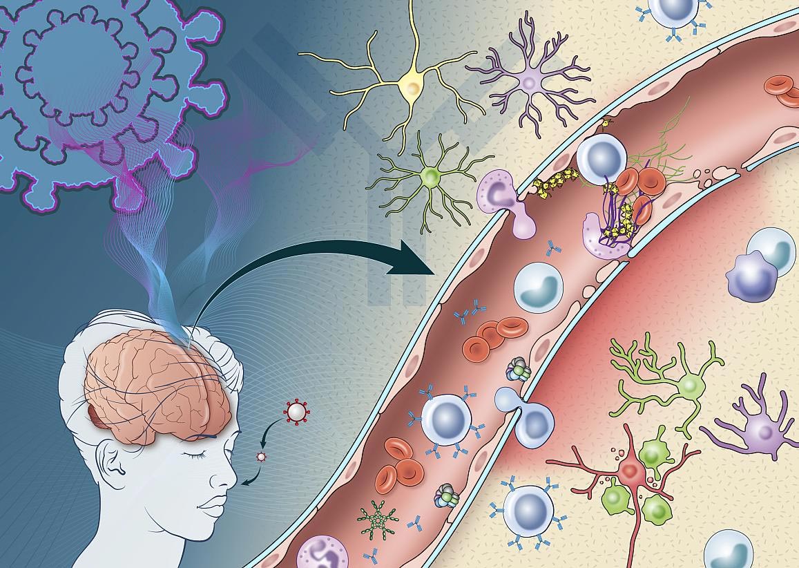 revealed-how-immune-response-triggered-by-covid-19-may-damage-the-brain