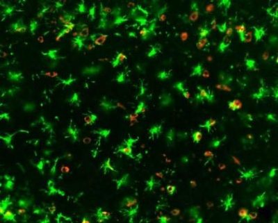 Microglia arrabbiata del cervello del topo infetto da COVID-19