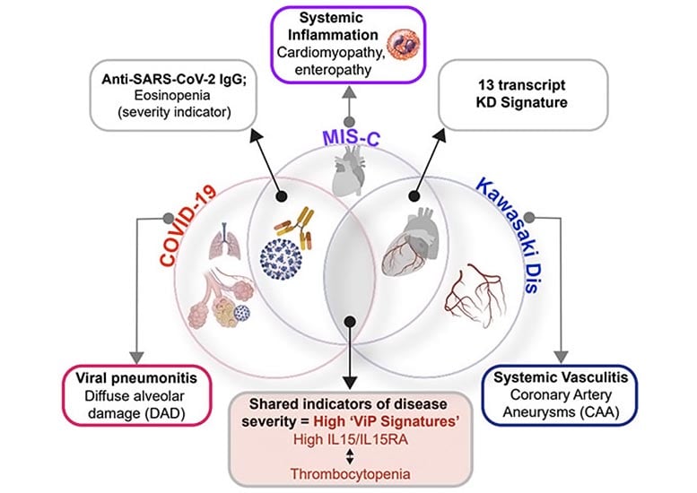 COVID-19, MIS-C and Kawasaki Disease