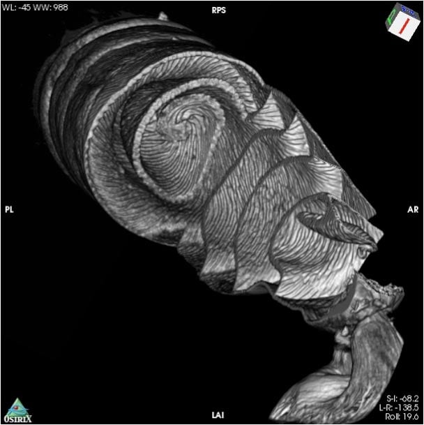 CT Scan Dogfish Shark Spiral Intestine