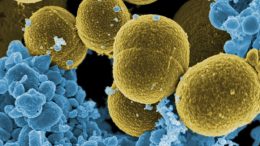 Calprotectin Fends off Microbial Invaders