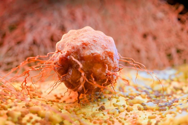Cancer Cell Growth and Metastasis