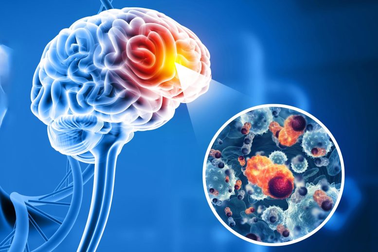 Cancer Cells Attacking Human Brain Crop