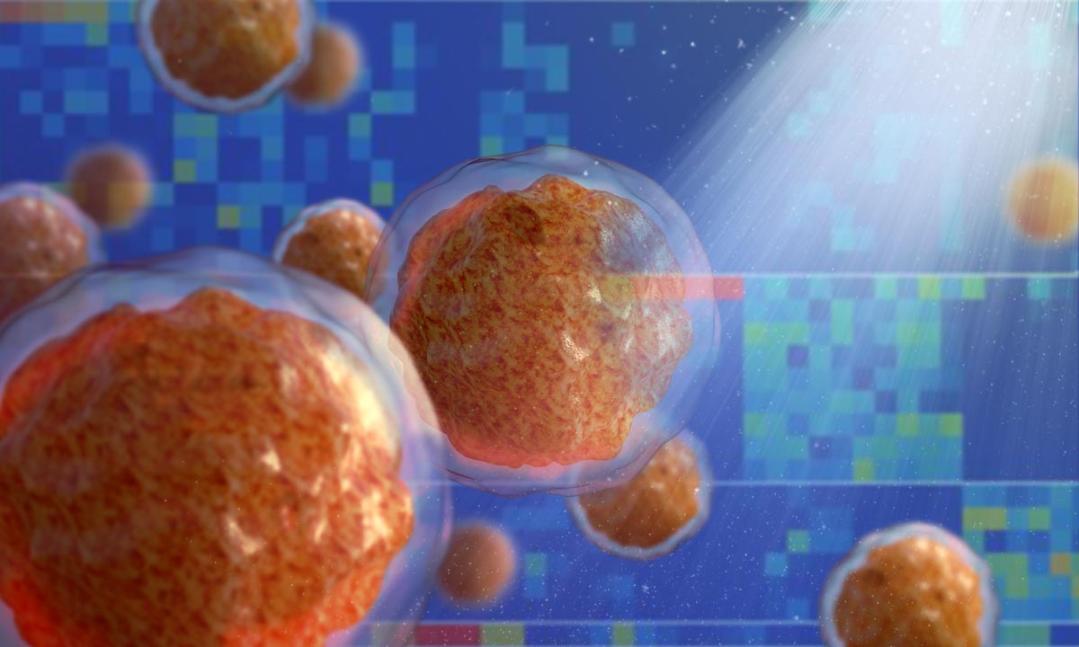 A Silent Bone Marrow Shift May Predict Leukemia Years Before It Starts