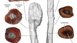 Cancerous and Non cancerous Dinosaur Bone Comparison
