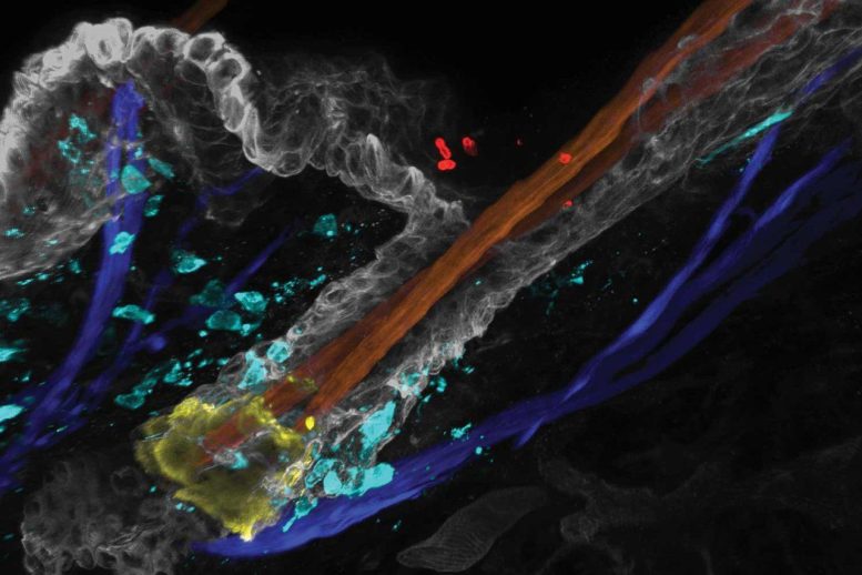 Candida auris Colonization of Hair Follicles
