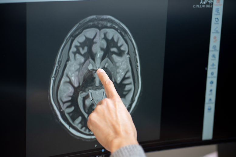 Casey Halpern Points to the Nucleus Accumbens on a Brain CT