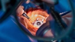 Cataract Surgery Eye Operation