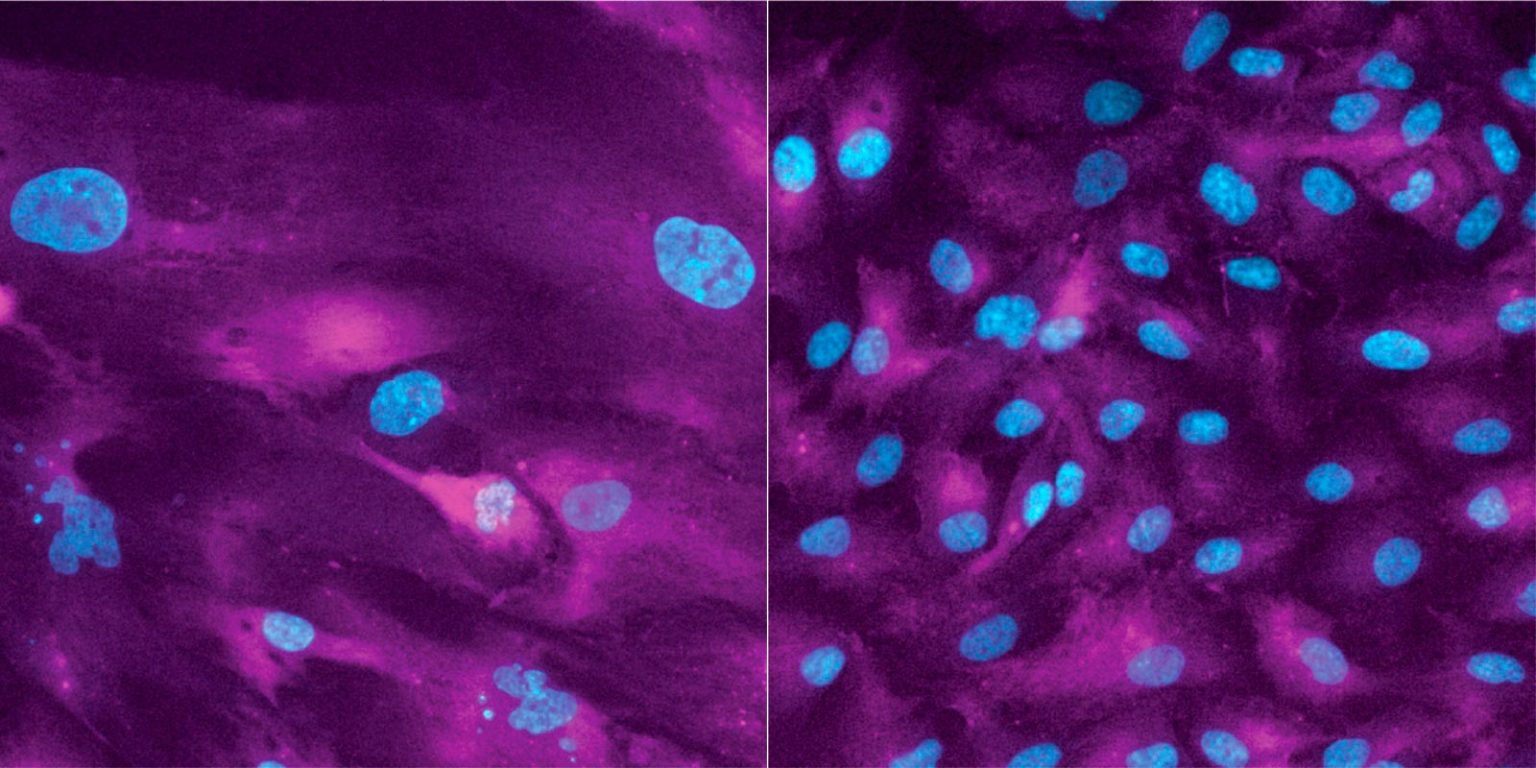The Paradox of Growth: Cancer’s Achilles’ Heel