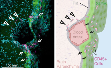 Central Nervous System Immune Cells SLYM
