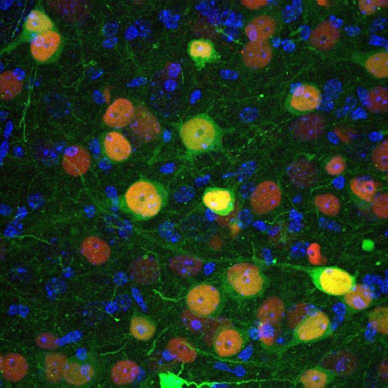 Cerebral Amygdala Neurons Identified Anxiety Social Disorders