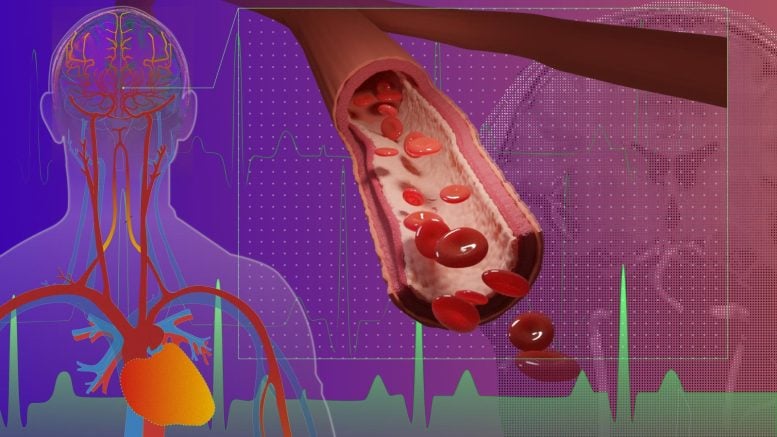 Cerebral Microvascular Volumetric Pulsatility