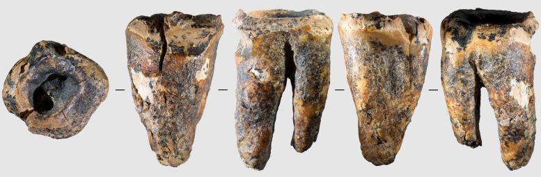 Chagyrskaya 64 Molar Tooth and Its Macro Feature, Five Projections