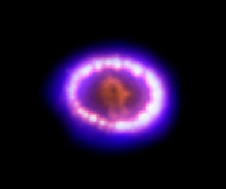 Chandra Supernova 1987A