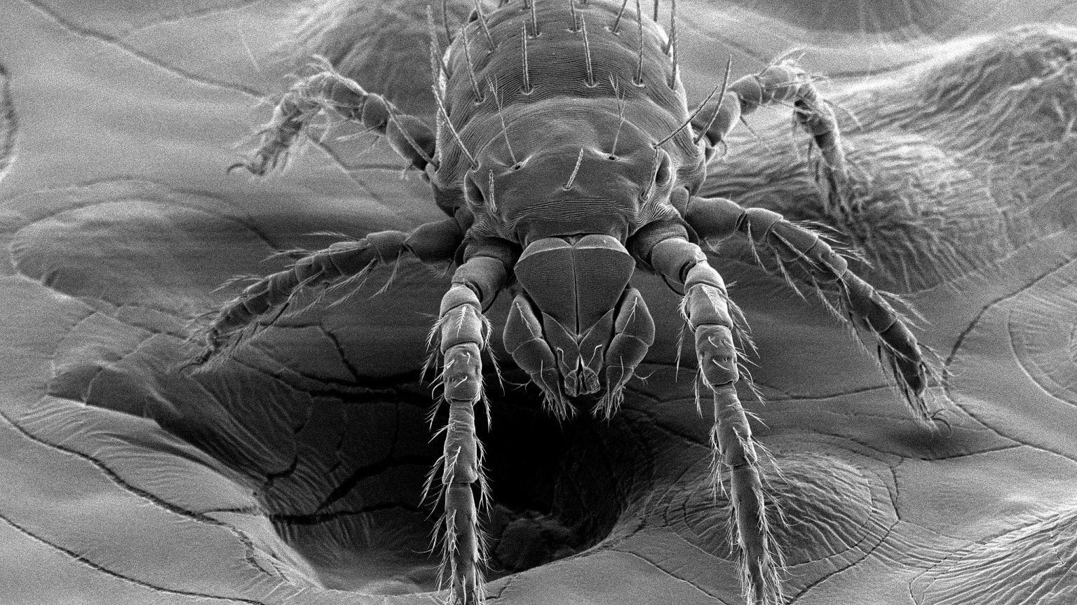 Scrub Typhus Bacteria Detected in NC Chiggers A Public Health Concern