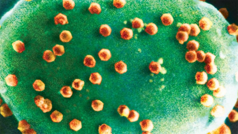 Chlorovirus Particles Infecting Microscopic Green Algae