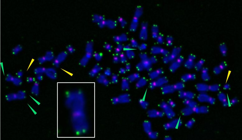 Chromosome Fragile Telomeres