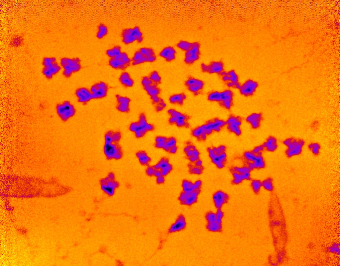 Photo of Chromosomes Measured