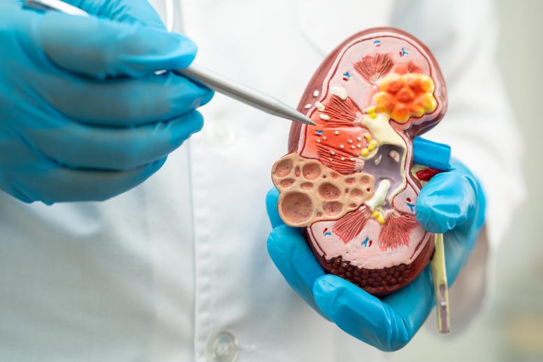 Chronic Kidney Disease Doctor Pointing Model