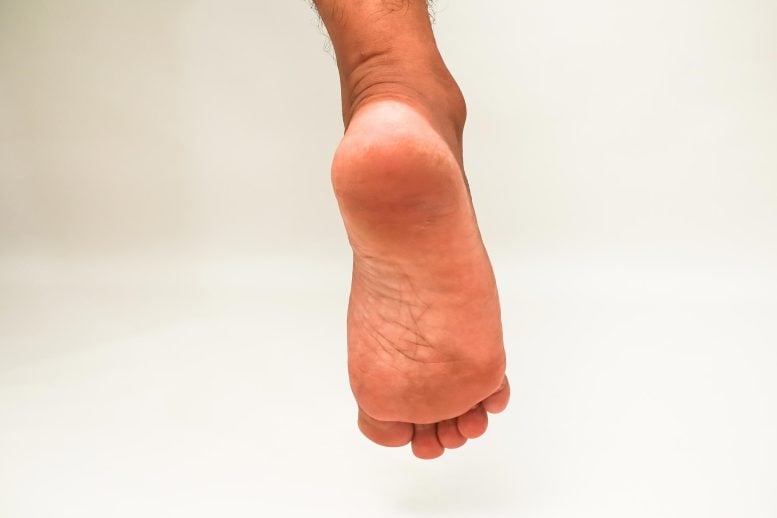 Close Up Man Foot Sole Toes