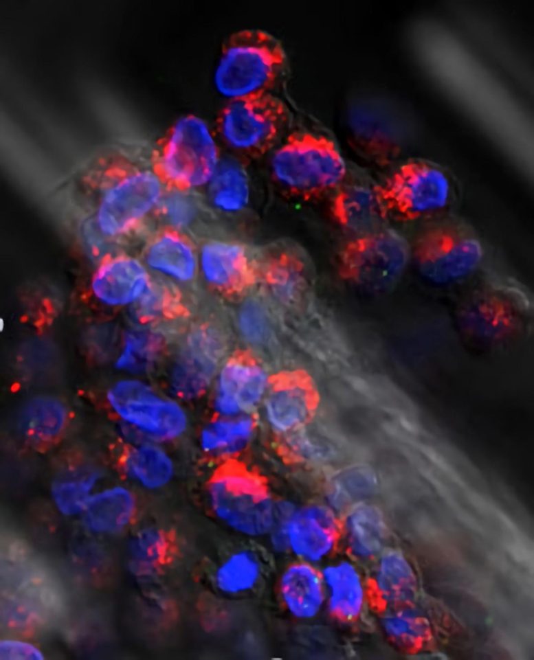 Cluster of Circulating Breast Cancer Tumor Cells