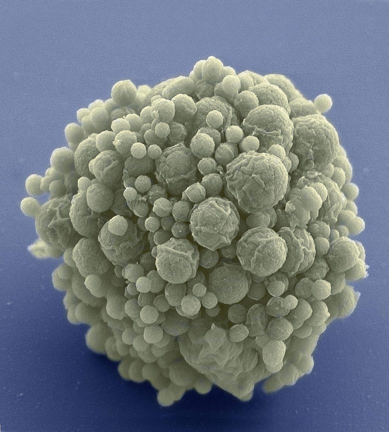 Cluster of Minimal Cells Electron Micrograph