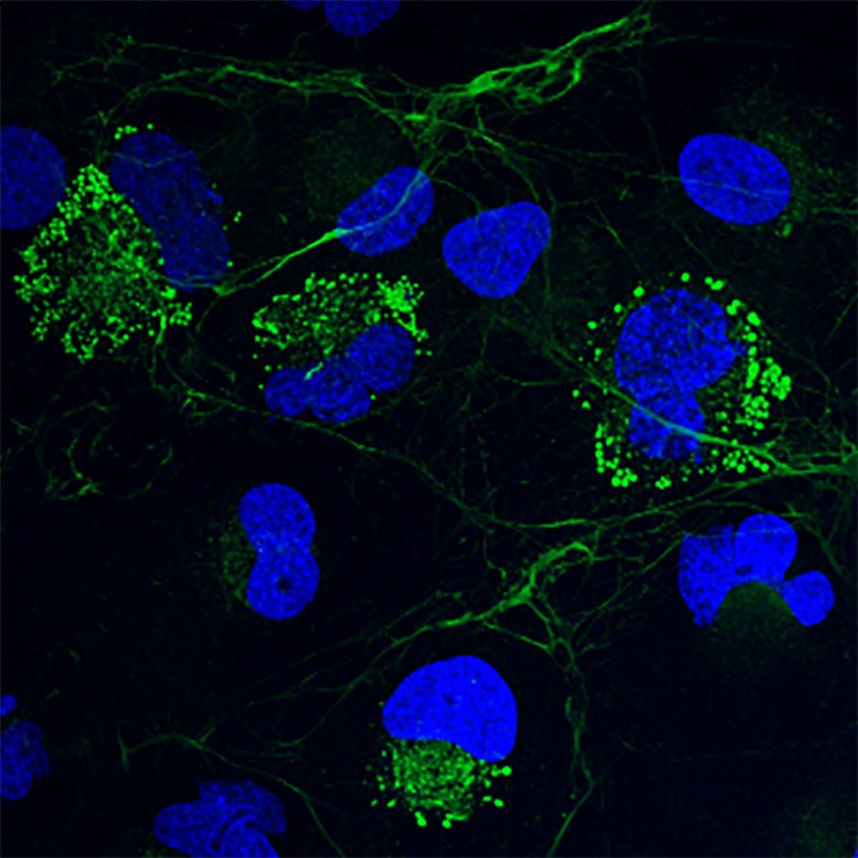 Collagen Producing Human Liver Cells