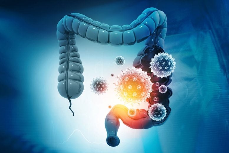 Colon Cancer Bacteria Viruses