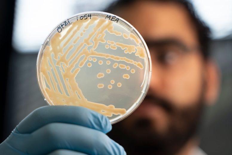 Colonies of Yeast Taken From Ötzi’s Stomach