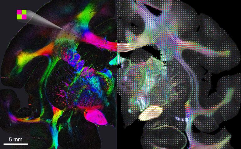 Uliminating Brain Illuminating Neural Pathways: A New Technique for Brain Imaging