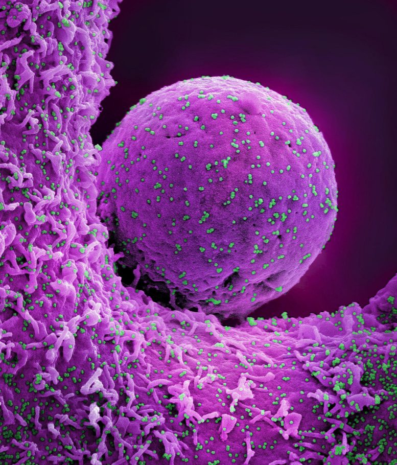 Colorized Scanning Electron Micrograph of a Cell Infected With the Omicron Strain of SARS CoV 2 Virus Particles