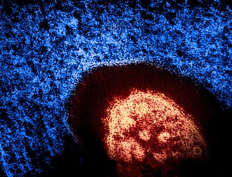 Colorized Transmission Electron Micrograph of Measles Virus Particle