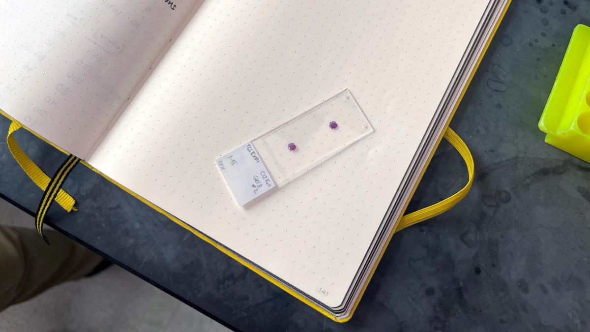 Columbia Scientists Made a Gel From Yogurt That Heals Tissue, and It Works