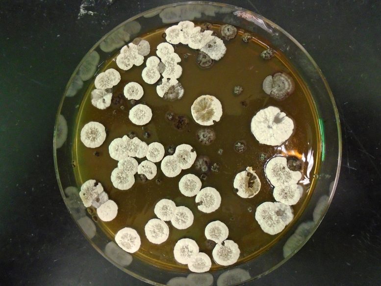 Common Bacteria Streptomyces