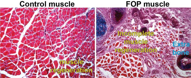 Comparison of Control and FOP Cell