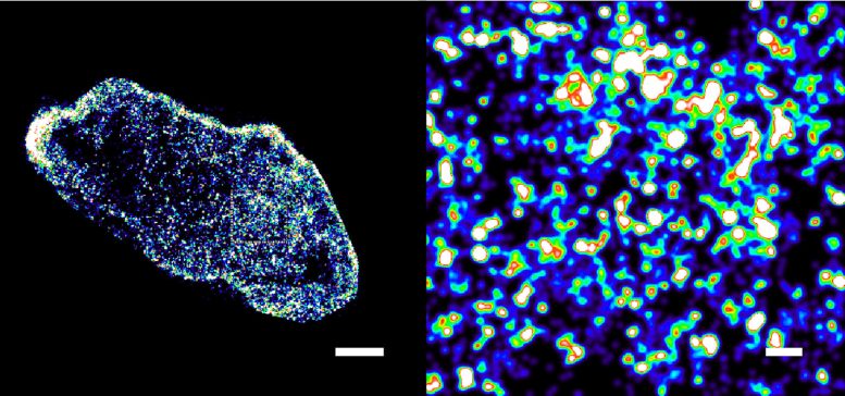Comparison of DNA Organization in Healthy and Cancer Cells