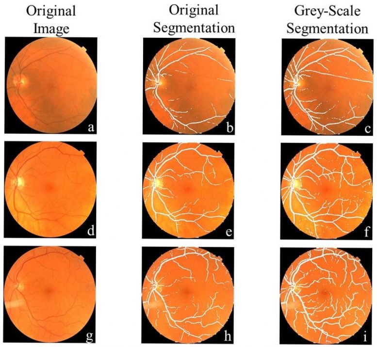Comparison of Eye Vessel Segmentation
