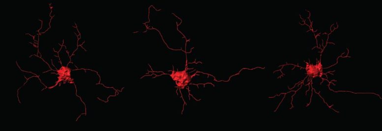 Computer Rendering of a Parvalbumin Positive Neuron